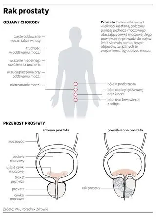 Rak prostaty