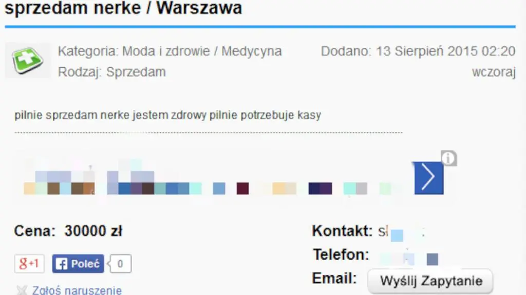 "Sprzedam nerkę"