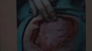 Szpital w Bełchatowie