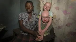 W Malawi porywane są nawet dzieci