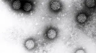 Wirus HPV
