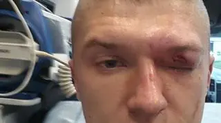 Wojciech Małecki doznał w meczu z Piastem groźnej kontuzji