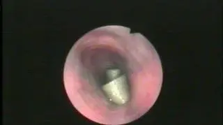 Wstążka połknięta przez kota, który "pomagał" właścicielce w szyciu