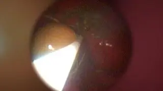 Wyciąganie piłki z psiego żołądka