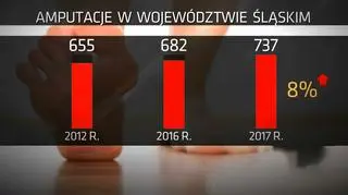 Wzrost przypadków amputacji stopy cukrzycowej w województwie śląskim