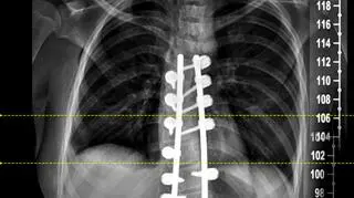 Zdjęcie po operacji 