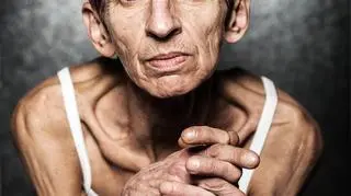 Zdjęcie pojedyncze - II miejsce w kategorii PORTRET SESYJNY, portret chorującej na anoreksję Emilii wykonany przez Mateusza Skwarczka („Gazeta Wyborcza Kraków”)