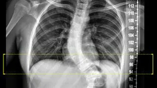 Zdjęcie przed operacją 