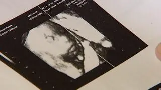 Zdjęcie USG syna Stanisława. "Ciąża przebiegała bez zarzutu"