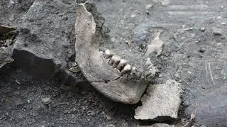 Żuchwa jednego ze skazańców 