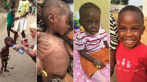 Hope ma teraz cztery lata