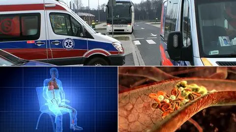Turystki z Rosji zabiła zakrzepica. To typowe schorzenie podróżnych