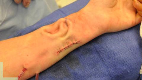 Ucho wyhodowane na ręku