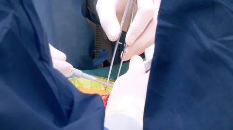 Powstaną prokuratorskiej działy ds. błędów lekarzy