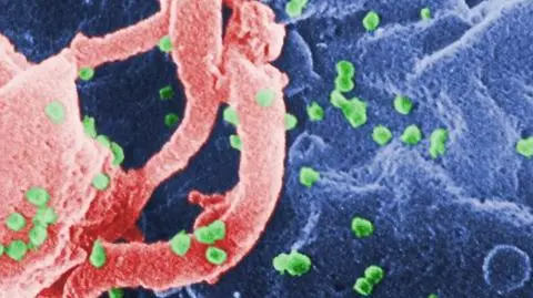 Niedługo HIV będzie "lekką infekcją" jak opryszczka?