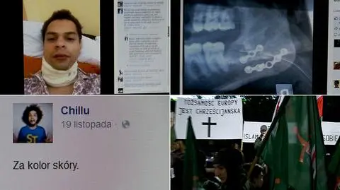 Muzyka zaatakowało siedmiu mężczyzn