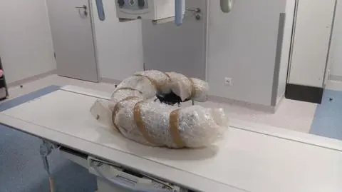 W szpitalu zbadali cios mamuta włochatego