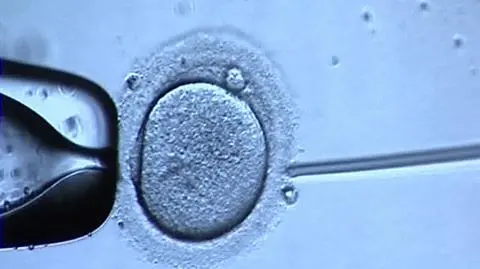 In vitro dzieli nie tylko posłów PO, PiS chce karać za tę metodę sztucznego zapłodnienia 