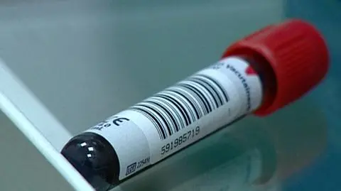 Połowa zakażonych nie wie, że ma HIV. A badanie trwa kwadrans