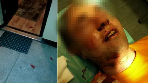 Wyważyli drzwi i pobili 25-letniego mieszkańca