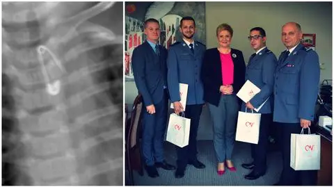 Niemowlę połknęło agrafkę. Prezydent miasta dziękuje za akcję