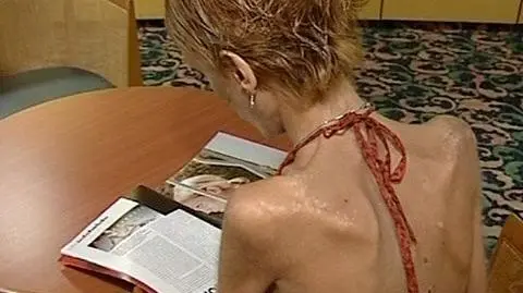 Mamy pierwszy ośrodek leczenia anoreksji