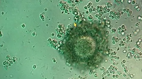 Spory o in vitro