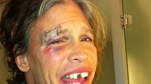 Steven Tyler wybił sobie zęby, a dzień później zagrał koncert