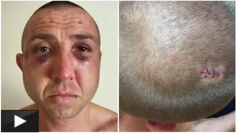 "Wyciągnęli z auta, pobili, razili paralizatorem". Prokuratura oskarża policjantów
