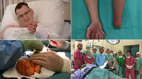 Pionierską operację przeprowadzono we Wrocławiu 