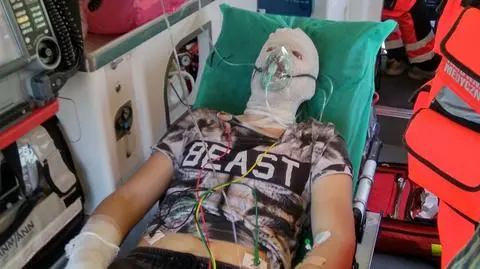 Nie wiadomo, dlaczego substancja wybuchła i poparzyła chłopaka 