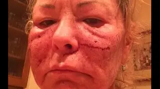 Tym zdjęciem Roseanne Barr wywołała konsternację nie tylko swoich fanów
