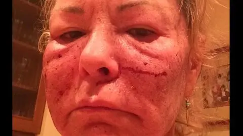 Roseanne Barr pobita przez Billa Cosby'ego? "Trywializuje traumę ofiar"