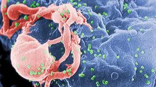 Wirusy HIV (zielone) wydostają się z limfocytu