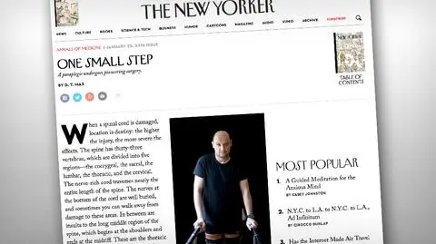 "New Yorker" o pionierskiej operacji wrocławskich lekarzy