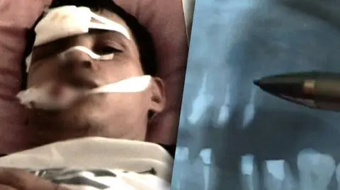 Poszedł do lekarza, stracił 14 zębów