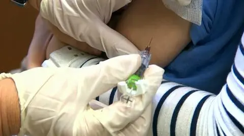 Measles outbreak in Szczecin. One hospital is no longer admitting patients