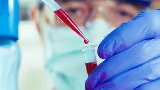  Do tej pory ebola zabiła około 8 tys. osób, a 20 tys. zaraziło się wirusem