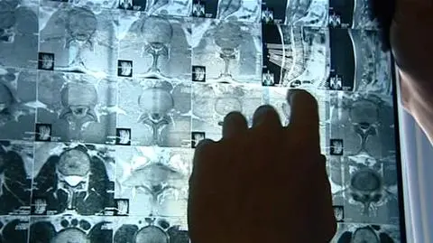 Lekarz ZUS: "Idź pajacu jeden, już idź"