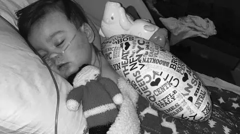 Alfie Evans nie żyje