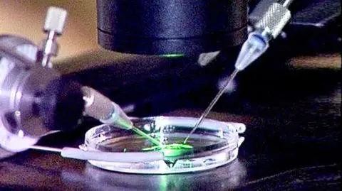 Poczta płaci za in vitro