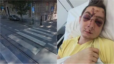 Kraków: policja zatrzymała 59-latka podejrzanego o potrącenie pieszego