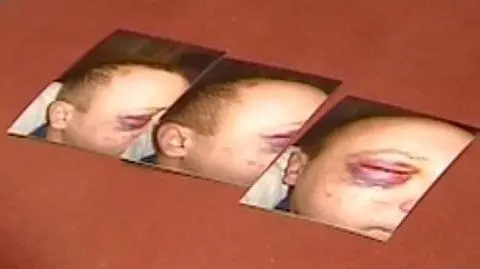 Skatowany na komisariacie?