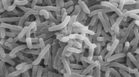 Cholera wyszła z kanałów