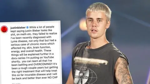 Justin Bieber ma boreliozę i mononukleozę - oświadczenie muzyka