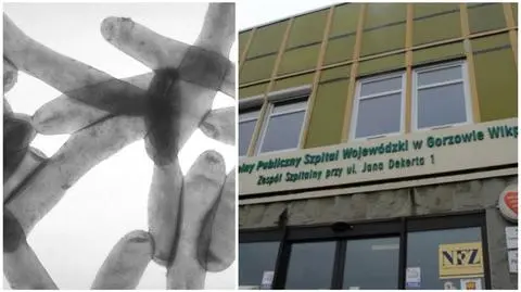 Skażona woda w szpitalu. Sanepid idzie do prokuratury