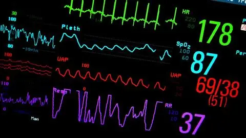 Koniec turystyki samobójców? Szwajcaria zagłosuje