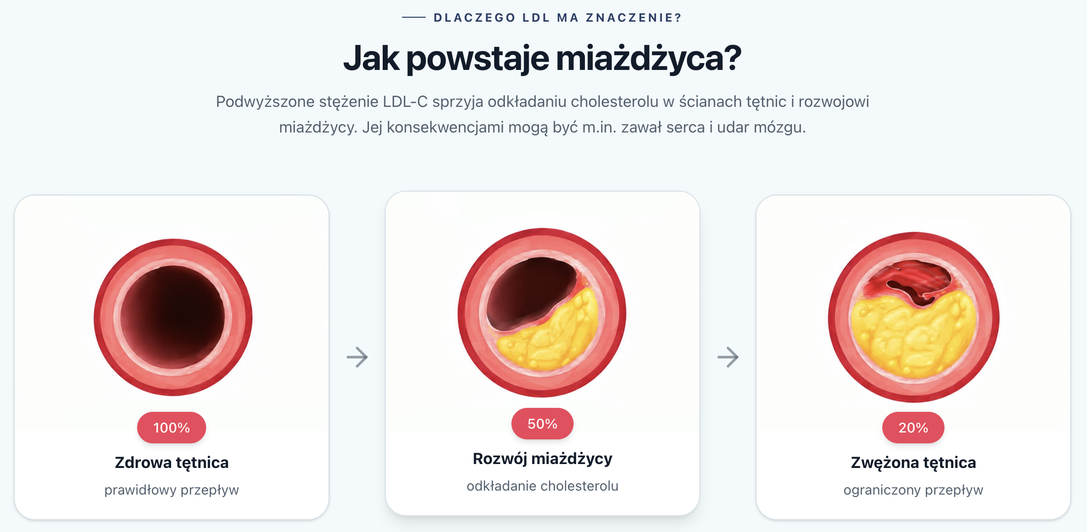 Jak powstaje miażdżyca?