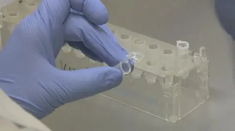 Na czym polega terapia przy pomocy nanobotów?