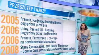 Najgłośniejsze przeszczepy twarzy na świecie